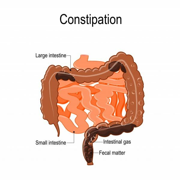 chronic constipation doctors in indore