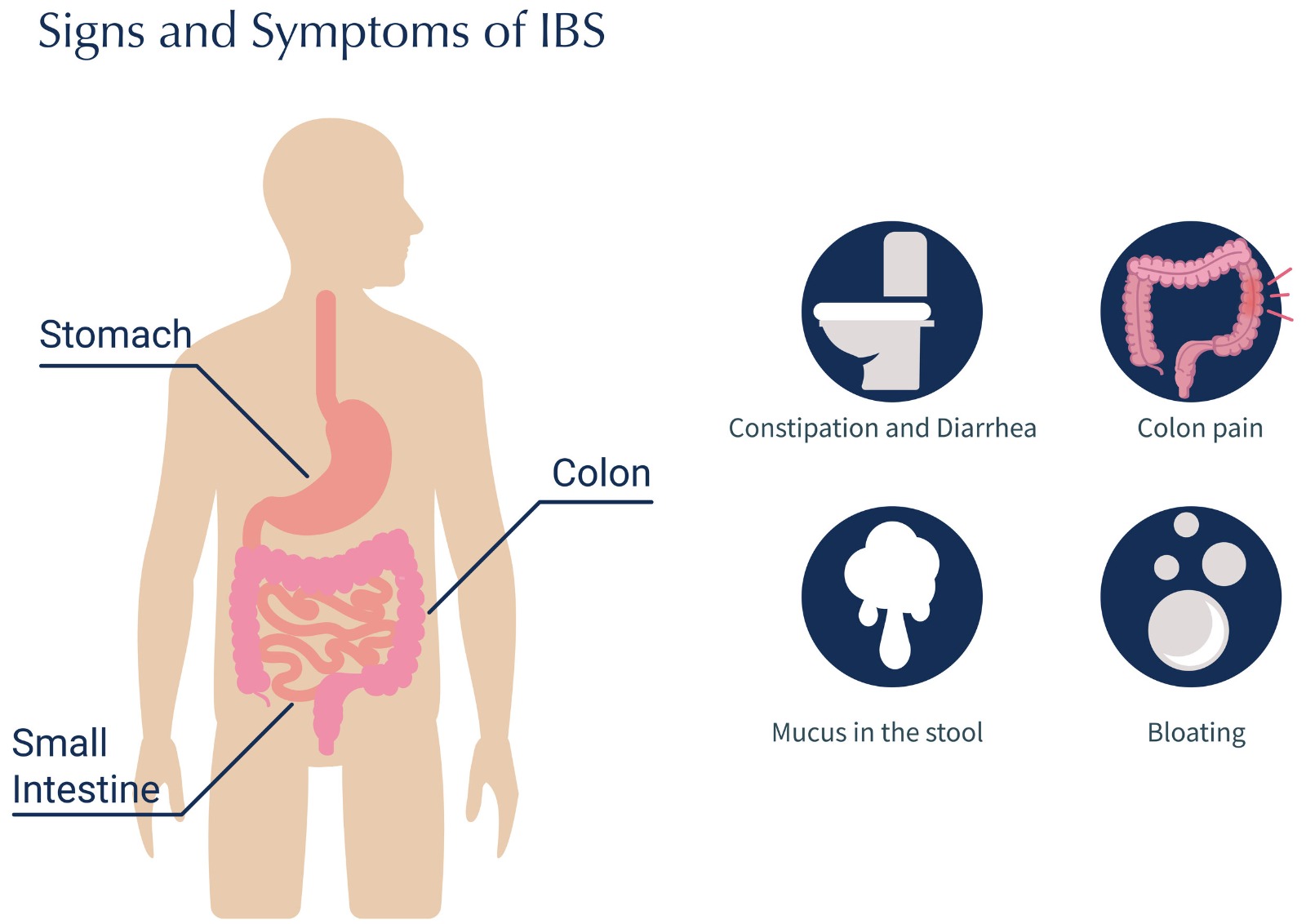 irritable bowel syndrome, gastroenterologist in indore